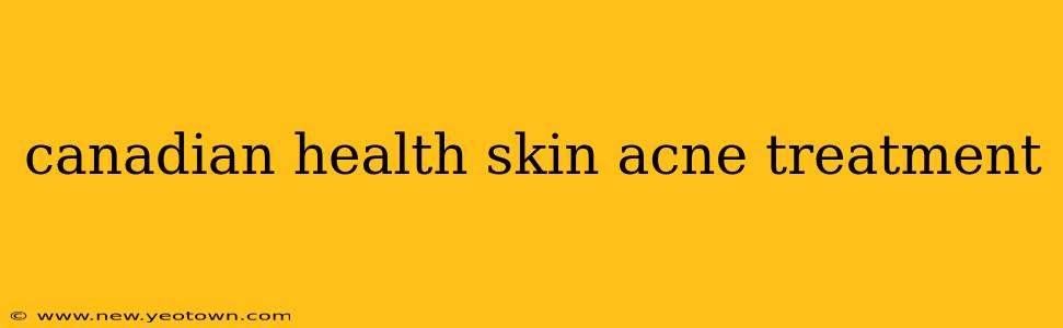 canadian health skin acne treatment