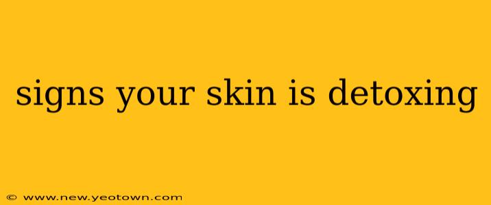 signs your skin is detoxing